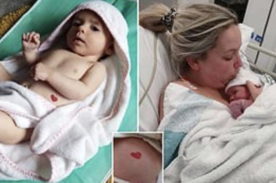 Histori e rrallë/ Foshnja e lindur në shkurt, njihet si vajza e vogël me zemrën e përsosur të dashurisë